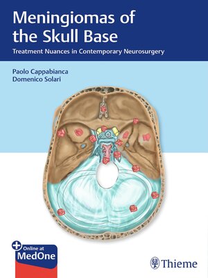 cover image of Meningiomas of the Skull Base